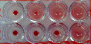ϸ(100ml/ƿ)