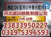 ´DVƬ