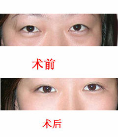 201471692818995.jpg