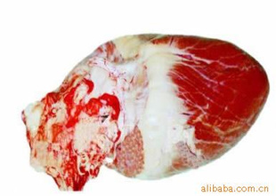 ¹