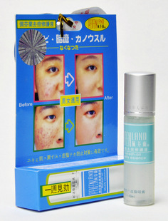 ȥ޻Һ(ǿ)10ml