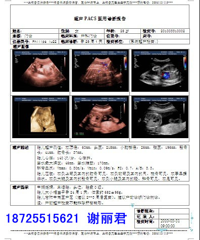 ʳBƬӡOKIC711dnͺ
