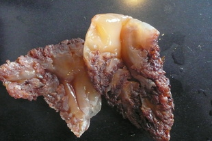ձںͷ