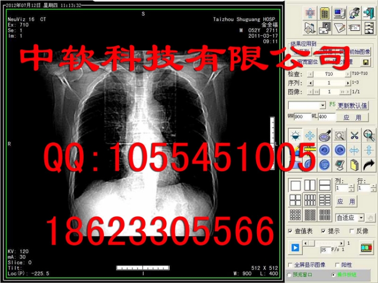 CT工作CT软件CT胶片打印